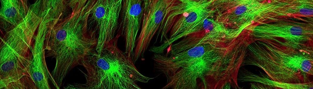 Fluorescence Microscopy